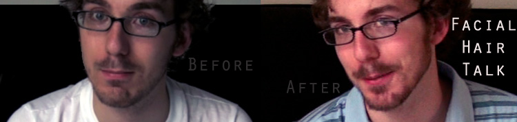 Facial Hair Talk Before and After Shots